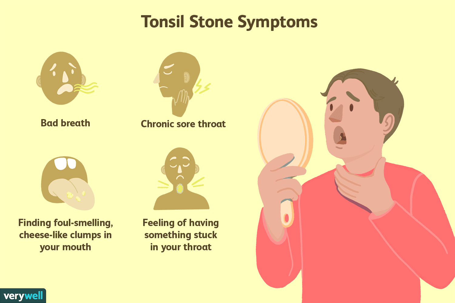Remove Tonsil Stones
